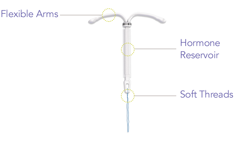Kyleena® diagram labeling its flexible arms, hormone reservoir, and soft threads